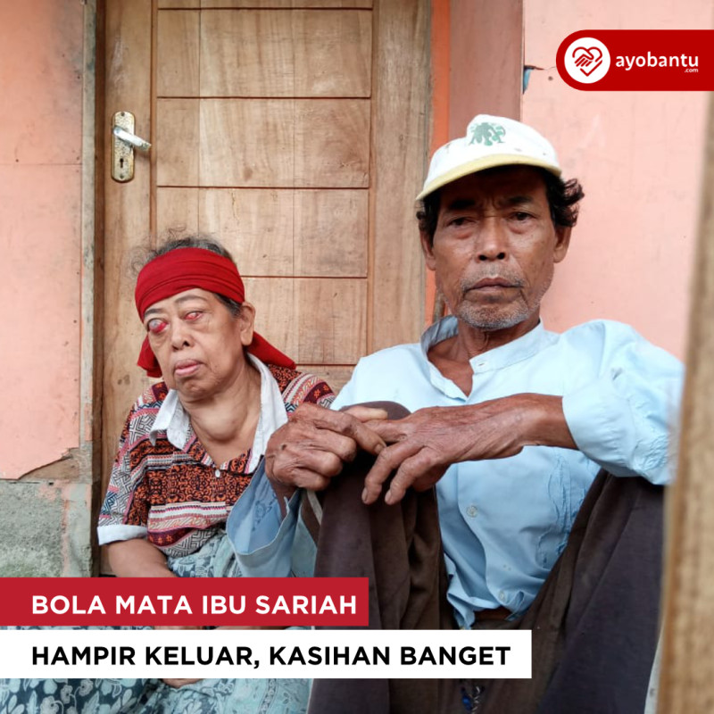 Bola Mata Ibu Sariah Hampir Keluar